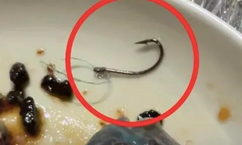 Khách phát hiện lưỡi câu trong đồ ăn, nhà hàng miễn hóa đơn hơn 22 triệu đồng