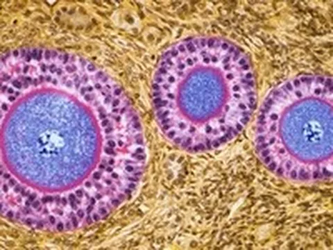 Nghiên cứu mới: Buồng trứng không 'nghỉ hưu' sau mãn kinh