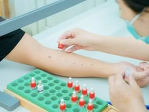 Dị ứng thức ăn và thuốc: Sai lầm từ thói quen tự chẩn đoán