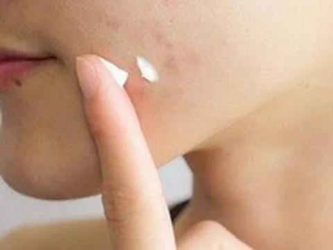Thu hồi 5 sản phẩm mỹ phẩm của Công ty Kencare Việt Nam