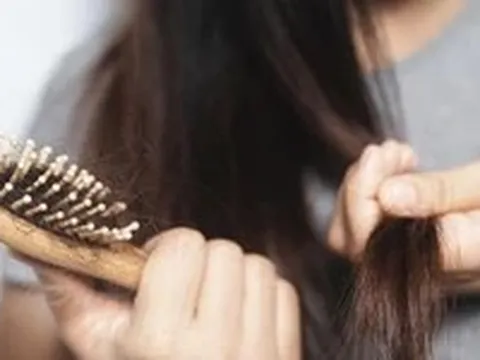 Rụng tóc nhiều, khám da liễu hay nội tiết?