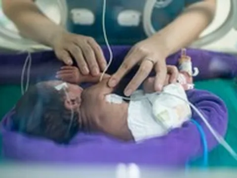 Úc phát triển nhau thai nhân tạo, mở ra hy vọng mới cho trẻ sinh non