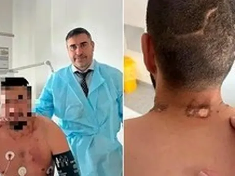 Anh lính Nga sống sót kỳ diệu khi bị gấu đuổi, dừng lại để đối phó lại bị sét đánh