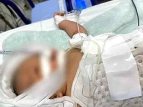 Bệnh viện Nhi đồng TP Cần Thơ lần đầu dùng kỹ thuật hạ thân nhiệt chỉ huy chữa trẻ sơ sinh bị thiếu oxy não